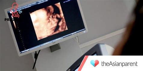 Ano Ang Congenital Anomaly Scan at Bakit Mahalaga Ito Sa .